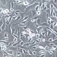 SJCRH30细胞系、SJCRH30细胞、SJCRH30骨髓横纹肌肉癌细胞