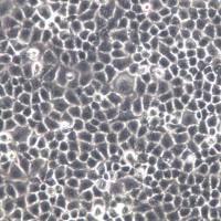 SPC-A-1细胞、SPC-A-1细胞系、SPC-A-1肺腺癌细胞