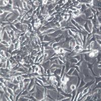 NCI-H446 细胞株、NCI-H446 细胞、NCI-H446 小细胞肺癌细胞;