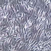 U-118 MG细胞系、U-118 MG细胞、U-118 MG脑星形胶质母细胞瘤