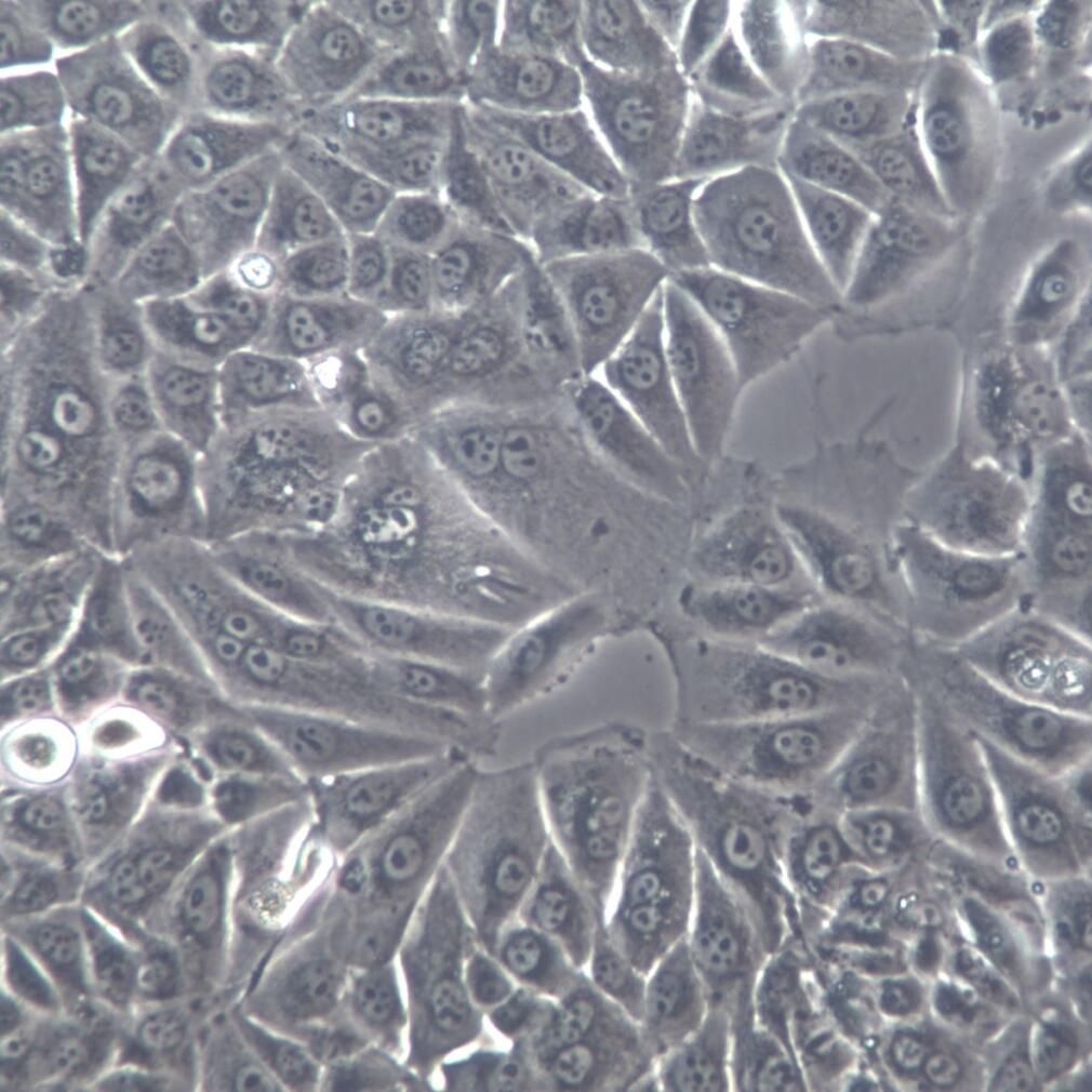 NCI-H226细胞株、NCI-H226细胞、NCI-H226肺鳞癌细胞