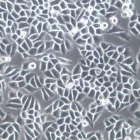 Hep-2细胞系、Hep-2细胞、Hep-2喉癌上皮细胞