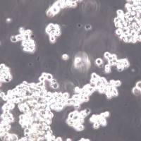 HuT 78细胞系、HuT78细胞、HuT 78T淋巴细胞白血病细胞