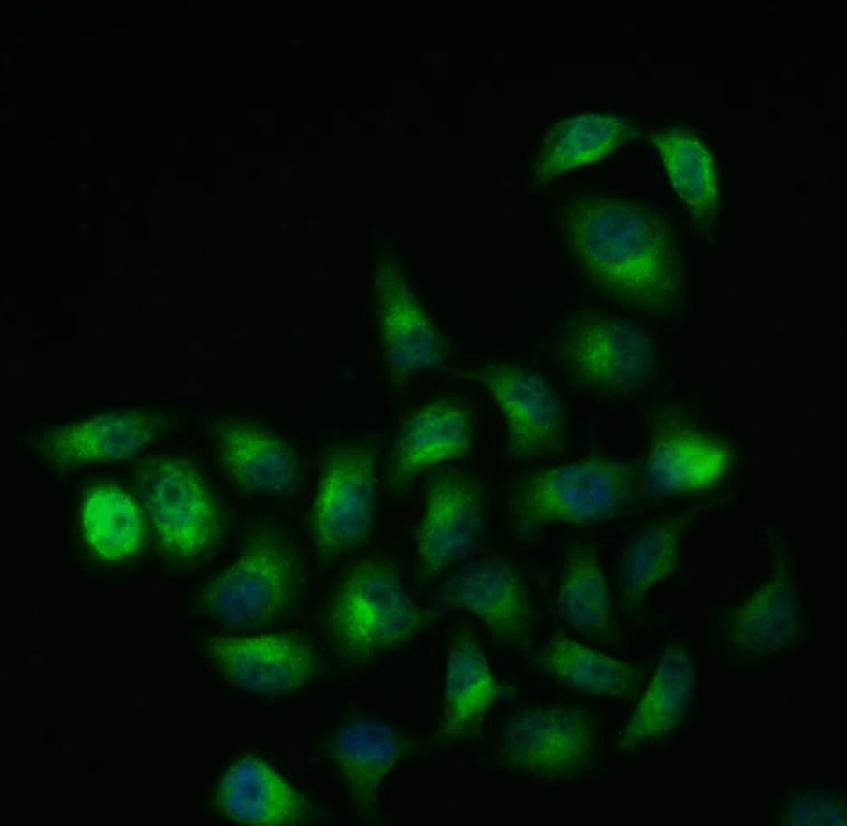 K010004P Anti-GSK3 Beta/GSK3B 