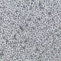 AMO-1细胞系、AMO-1细胞、AMO-1骨髓浆细胞瘤细胞