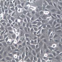 T24;人膀胱移行细胞癌细胞、T24细胞;T24细胞