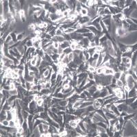 UM-UC-3细胞、UM-UC-3细胞系、UM-UC-3膀胱移行细胞癌