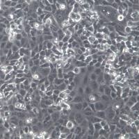 IOMM-Lee细胞株、IOMM-Lee细胞、IOMM-Lee细胞系