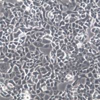 RPMI-2650细胞系、RPMI-2650细胞、RPMI-2650鼻中隔鳞状癌细胞