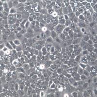 NCI-H292细胞株、NCI-H292细胞、NCI-H292肺癌细胞