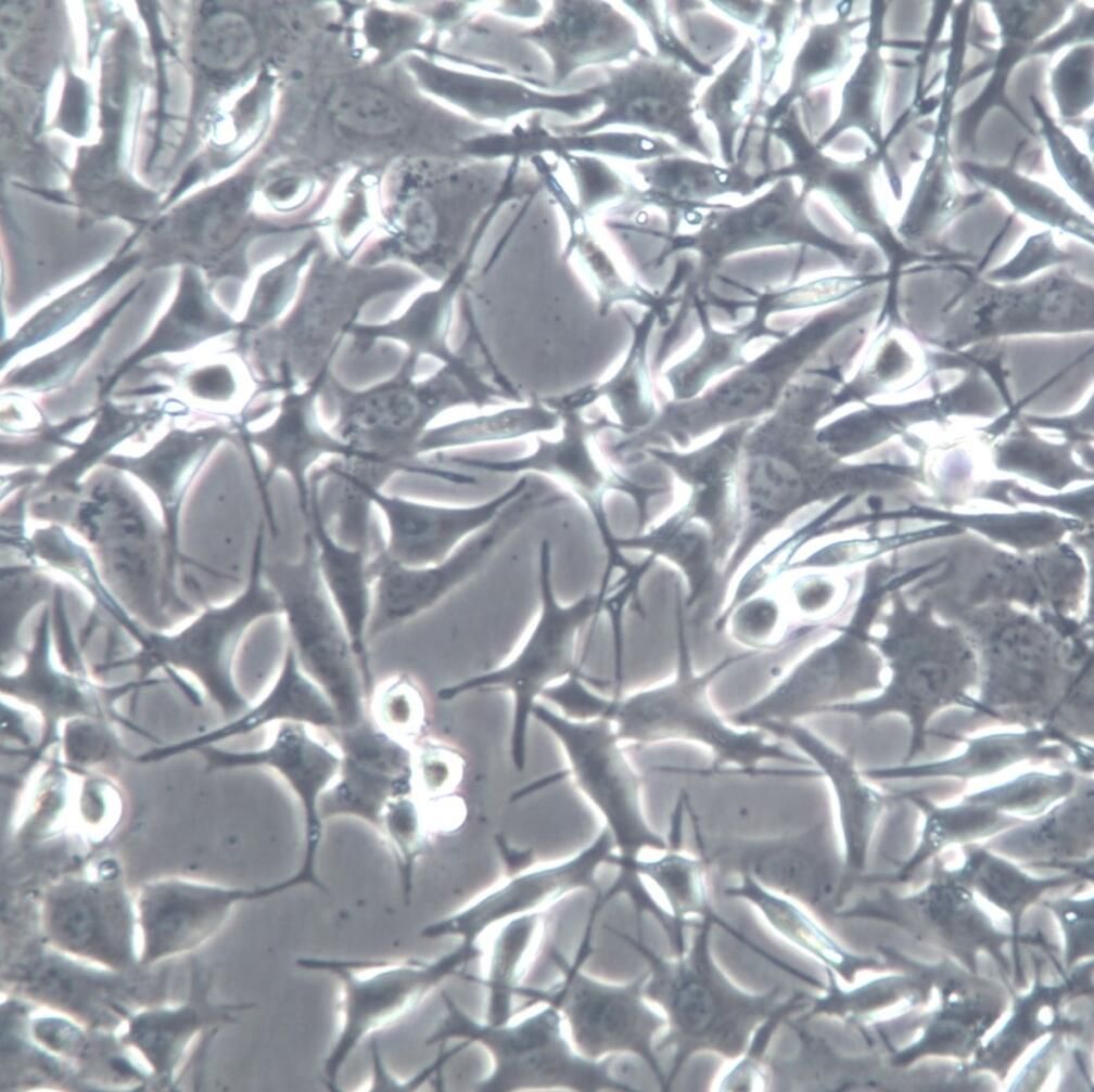 MP46细胞系、MP46细胞、MP46眼葡萄膜黑色瘤細胞