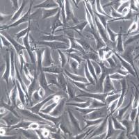 SK-MEl-28细胞系、SK-MEl-28细胞、SK-MEl-28皮肤恶性黑色素瘤细胞