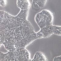 SW-1116细胞株、SW-1116细胞、SW-1116结肠腺癌细胞      