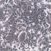 MCF7细胞系、MCF7细胞、MCF7乳腺癌细胞   