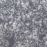 SW620细胞株、SW620细胞、SW620结直肠腺癌细胞