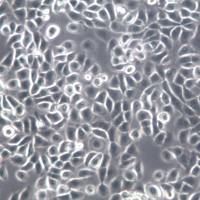 NPC/HK1细胞系、NPC/HK1细胞、NPC/HK1鼻咽癌细胞