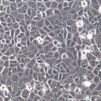 OV-90 细胞系、OV-90 细胞、OV-90 卵巢癌细胞