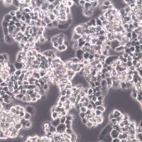 COV434细胞系、COV434细胞、COV434卵巢颗粒肿瘤细胞