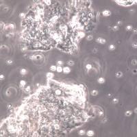 KG-1细胞系、KG-1细胞、KG-1急性骨髓性白血病细胞