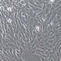 SUM159PT细胞株、SUM159PT细胞、SUM159PT乳腺癌细胞