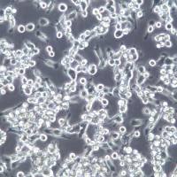 NUGC-4细胞系、NUGC-4细胞、NUGC-4胃癌细胞