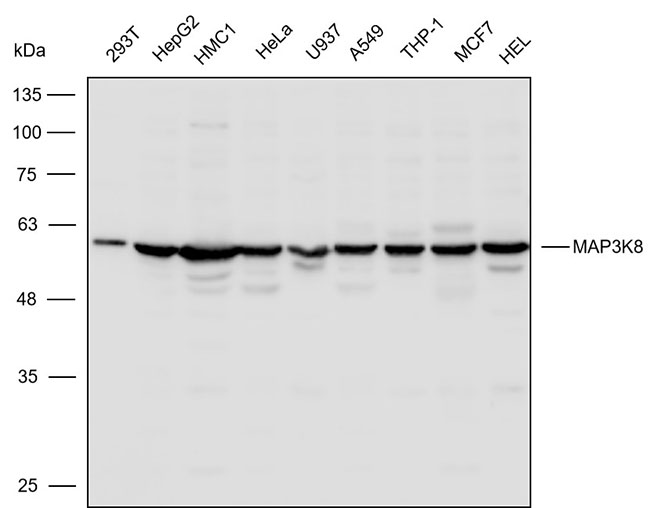 K114147P Anti-MAP3K8 Polyclona