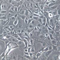 KLE细胞系、KLE细胞、KLE子宫内膜腺癌细胞