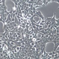 SACC-83 人涎腺腺样囊性癌细胞