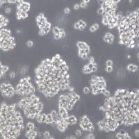 WSU-DLCL-2细胞系、WSU-DLCL-2细胞、WSU-DLCL-2弥漫大B淋巴瘤细胞