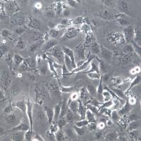 TE-1细胞；TE-1食管癌、TE-1细胞株