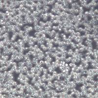 NAMALWA细胞系、NAMALWA细胞、NAMALWABurkitts淋巴瘤细胞