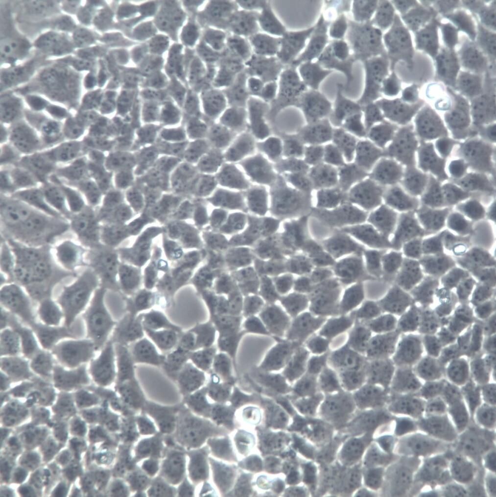 HTR-8/SVneo 细胞系、HTR-8/SVneo 细胞、HTR-8/SVneo 绒毛膜滋养层细胞