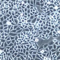 PC14细胞系、PC14细胞、PC14肺癌细胞株