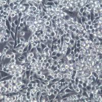 MIA-PACA-2 细胞株、MIA-PACA-2 细胞、MIA-PACA-2 胰腺导管癌细胞