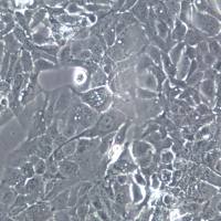 HT-1376 细胞、HT-1376 细胞系、HT-1376 膀胱癌细胞