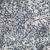 MDA-MB-468细胞系、MDA-MB-468细胞、MDA-MB-468乳腺癌细胞