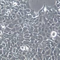 HCC827细胞系、HCC827细胞、HCC827非小细胞肺癌细胞