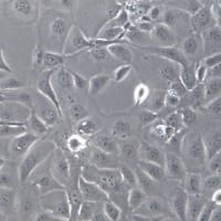 HCC1937细胞系、HCC1937细胞、HCC1937乳腺癌细胞