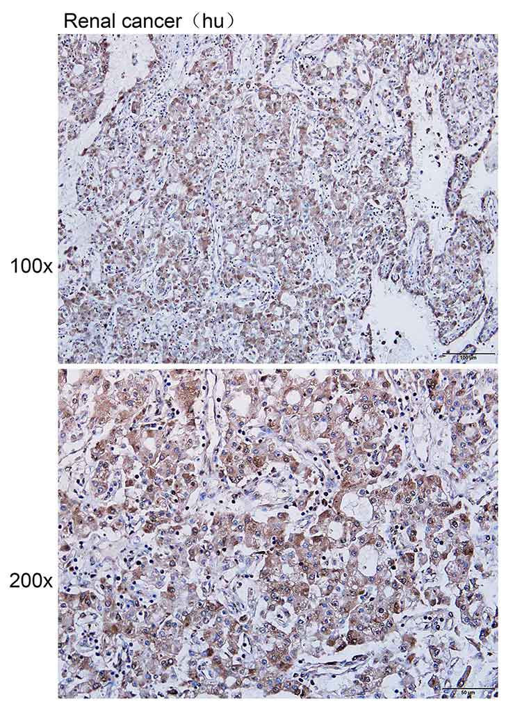 K114060P Anti-RBP5 Polyclonal 
