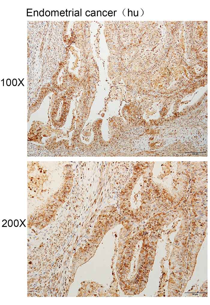 K114134P Anti-RIPK2 Polyclonal