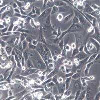 SK-Hep-1细胞系、SK-Hep-1细胞、SK-Hep-1肝癌细胞