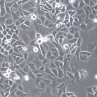 NCI-H522[H522] 人非小细胞肺癌细胞