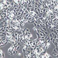 RT-112细胞、RT-112细胞系、RT-112膀胱癌细胞