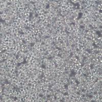 RAMOS;人B淋巴细胞瘤细胞、ramos细胞