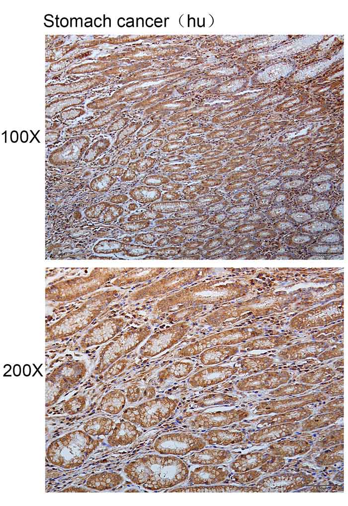 K114131P Anti-PFKFB1 Polyclona