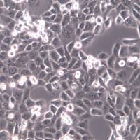 CAL 27细胞、CAL 27细胞系、CAL 27舌鳞癌细胞