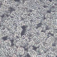 L5178Y TK+/- clone (3.7.2C)细胞、L5178Y TK+/- clone (3.7.2C)细胞株、L5178Y TK+/- clone (3.7.2C)细胞系