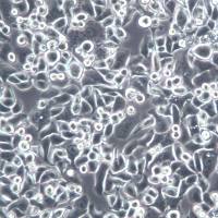 AU565细胞系、AU565细胞、AU565乳腺癌细胞