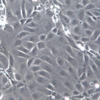 SNU216细胞株、SNU216细胞、SNU216细胞系