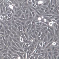 U2OS 细胞、U2OS 细胞系、U2OS 骨肉瘤细胞